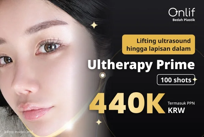 Ultherapy Prime 100 shots product image