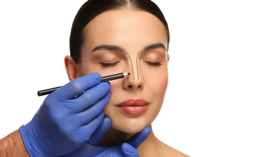Rhinoplasty