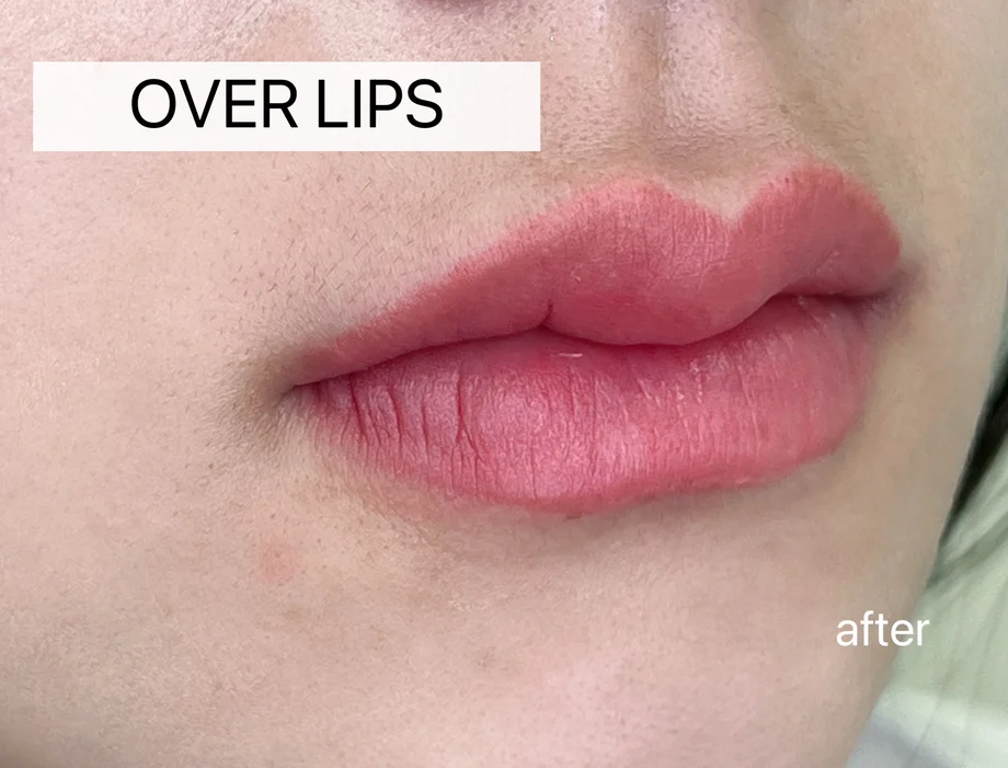 Lip Blush - Over-lip