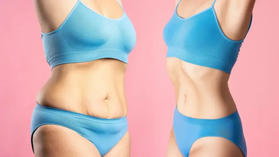 高清内窥镜乳腺手术