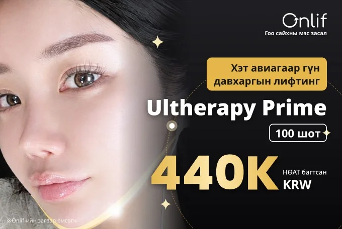 Ultherapy Prime 100 шот product image